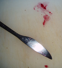 Picture of a jelly smear shaped like North and South America
